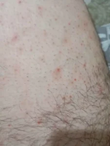 Arodia Therapy Anında Etkili Tüy Dökücü Krem (250 ml) photo review